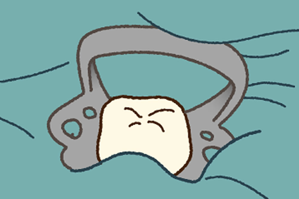ラバーダム