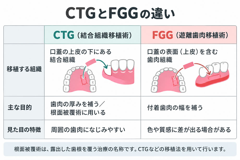 CTGとFGGの比較